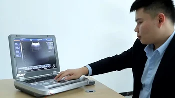 Dizüstü Bilgisayar 3d Renkli Bebek Ultrason Tarayıcı Ekipmanları Taşınabilir Ultrason Makinesi ultrason modeli